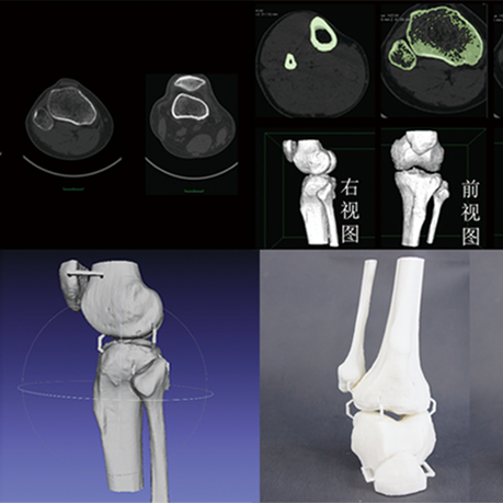 CT数据三维重建骨骼模型，骨骼模型精细化建模修复，骨骼模型3D打印快速成型