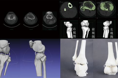 CT数据三维重建骨骼模型，骨骼模型精细化建模修复，骨骼模型3D打印快速成型