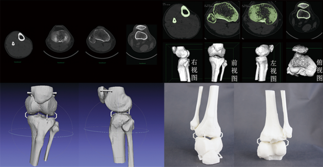 CT数据三维重建骨骼模型，骨骼模型精细化建模修复，骨骼模型3D打印快速成型