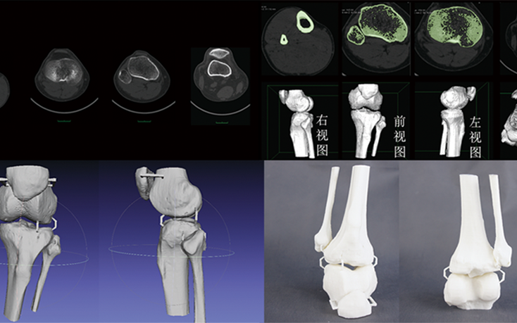 CT数据三维重建骨骼模型，骨骼模型精细化建模修复，骨骼模型3D打印快速成型