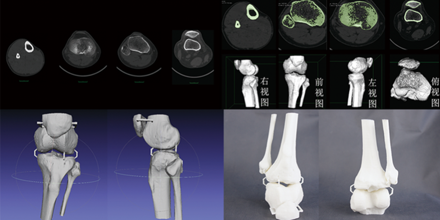 ct3d CT数据三维重建骨骼模型,骨骼模型精细化建模修复,骨骼模型3D打印快速成型
