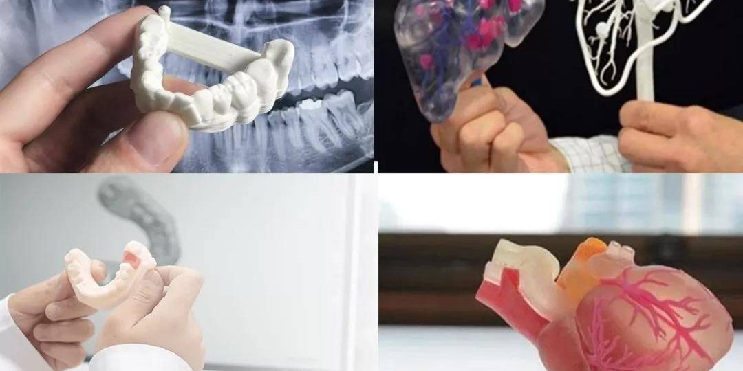 CT数据三维重建，医学3D打印技术在骨科中的具体应用