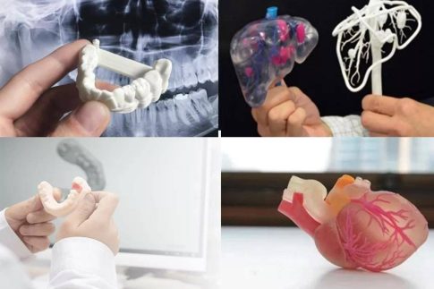 CT数据三维重建，医学3D打印技术在骨科中的具体应用