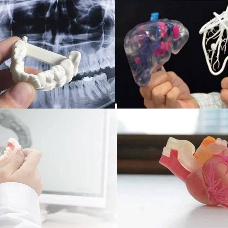 CT数据三维重建，医学3D打印技术在骨科中的具体应用