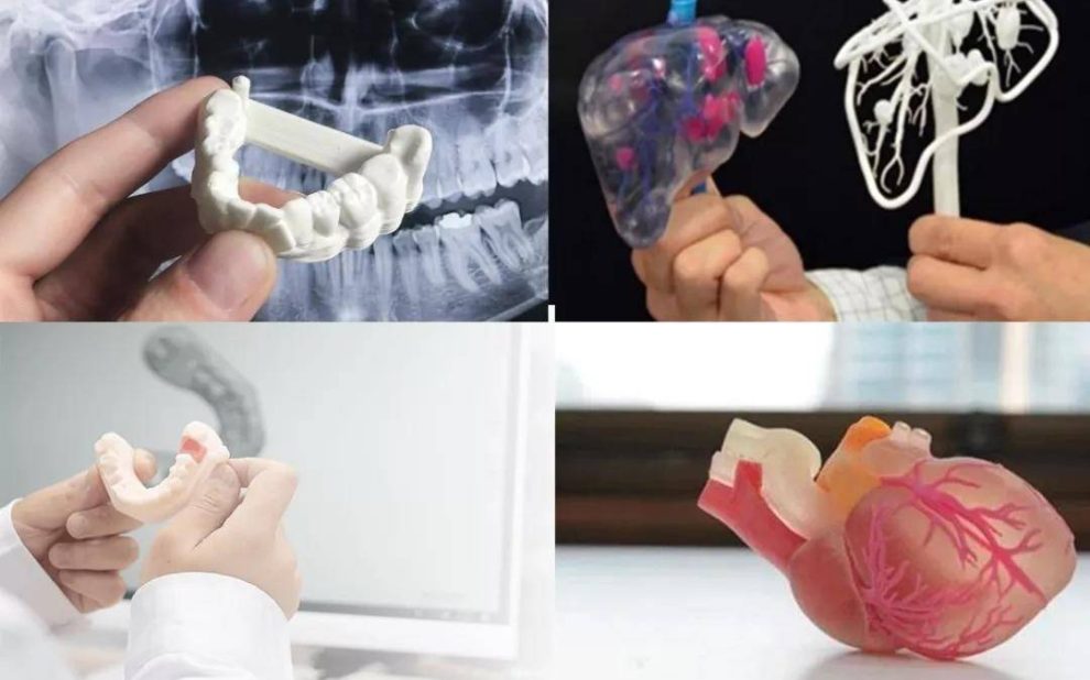 CT数据三维重建，医学3D打印技术在骨科中的具体应用