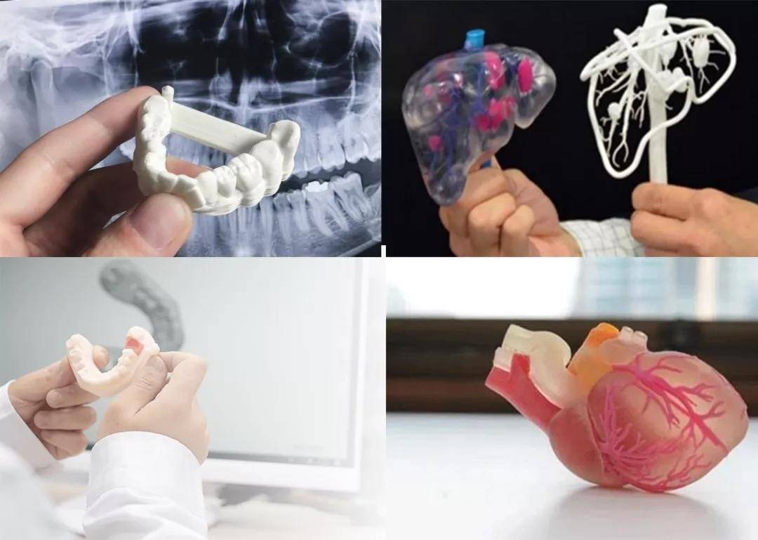 CT数据三维重建，医学3D打印技术在骨科中的具体应用
